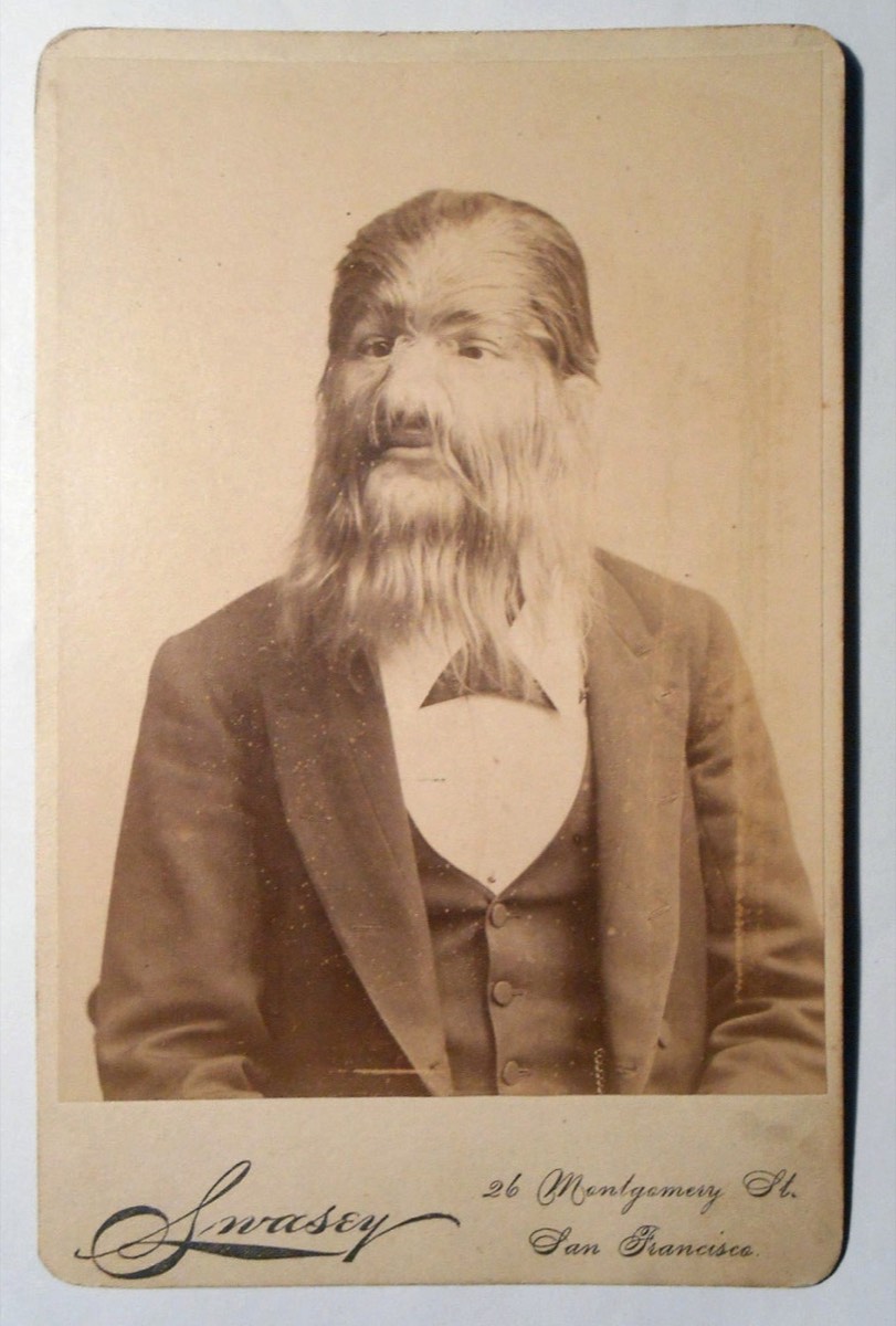 Fedor Jeftichew, o “Jo-Jo, o menino com cara de cão”, portador de hipertricose, fotografado entre 1888 e 1896